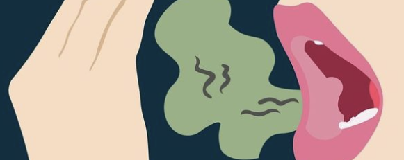 Penyebab Bau Mulut Padahal Sudah Sikat Gigi yang Perlu Diwaspadai